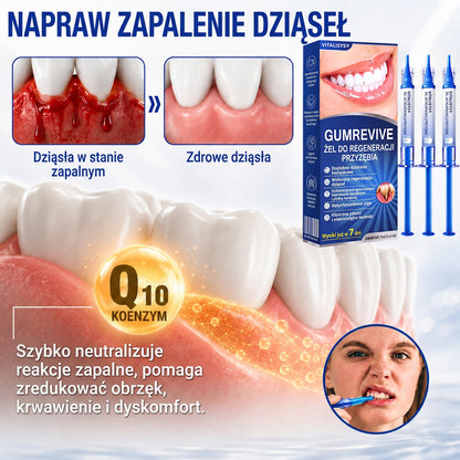 🇵🇱 𝑽𝒊𝒕𝒂𝒍𝒊𝒔𝒚𝒔®🦷 𝑮𝒖𝒎𝑹𝒆𝒗𝒊𝒗𝒆 𝑷𝒂𝒓𝒐𝒅𝒐𝒏𝒕𝒂𝒍𝒏𝒚 𝑮𝒆𝒍 𝑶𝒅𝒏𝒂𝒘𝒊𝒂𝒋ą𝒄𝒚🍇