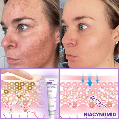 Vitalisys®🍇 PDRN Multi-Peptide Krem do masażu w rolerze do ciała — przeciwstarzeniowy, nawilżający, ujędrniający i liftingujący, wspiera regenerację skóry, wyrównuje koloryt, pomaga w pielęgnacji niedoskonałości i ciemnych plam.