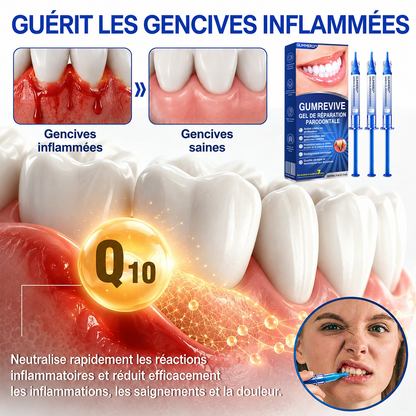 🇫🇷 𝑮𝒍𝒊𝒎𝒎𝒆𝒓𝒍𝒚®🦷 𝑮𝒖𝒎𝑹𝒆𝒗𝒊𝒗𝒆 𝑮𝒆𝒍 𝒅𝒆 𝑹é𝒑𝒂𝒓𝒂𝒕𝒊𝒐𝒏 𝑷𝒂𝒓𝒐𝒅𝒐𝒏𝒕𝒂𝒍𝒆💎