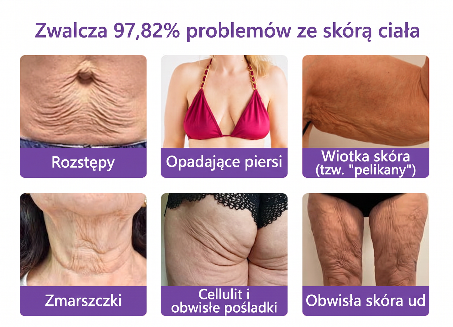 Vitalisys®🍇 PDRN Multi-Peptide Krem do masażu w rolerze do ciała — przeciwstarzeniowy, nawilżający, ujędrniający i liftingujący, wspiera regenerację skóry, wyrównuje koloryt, pomaga w pielęgnacji niedoskonałości i ciemnych plam.