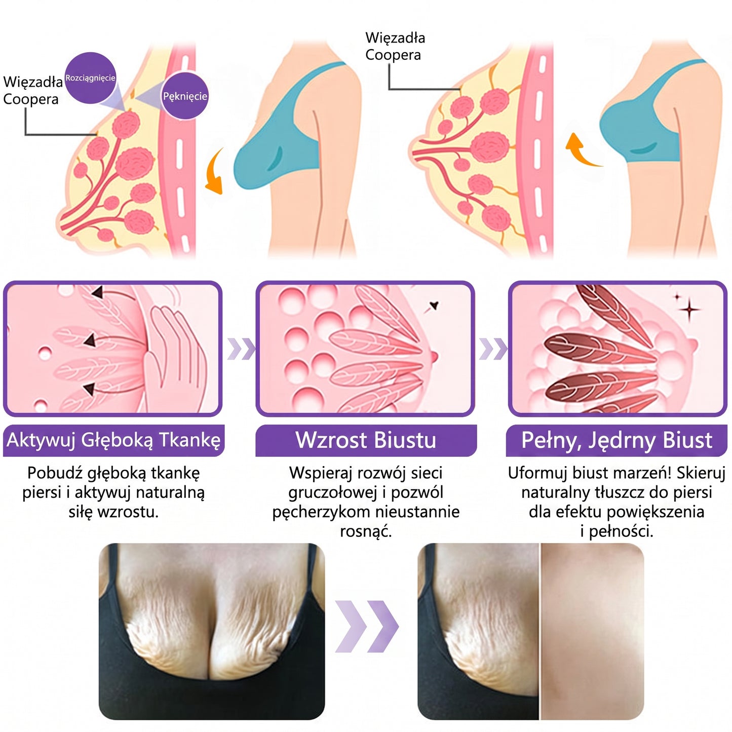 Vitalisys®🍇 PDRN Multi-Peptide Krem do masażu w rolerze do ciała — przeciwstarzeniowy, nawilżający, ujędrniający i liftingujący, wspiera regenerację skóry, wyrównuje koloryt, pomaga w pielęgnacji niedoskonałości i ciemnych plam.