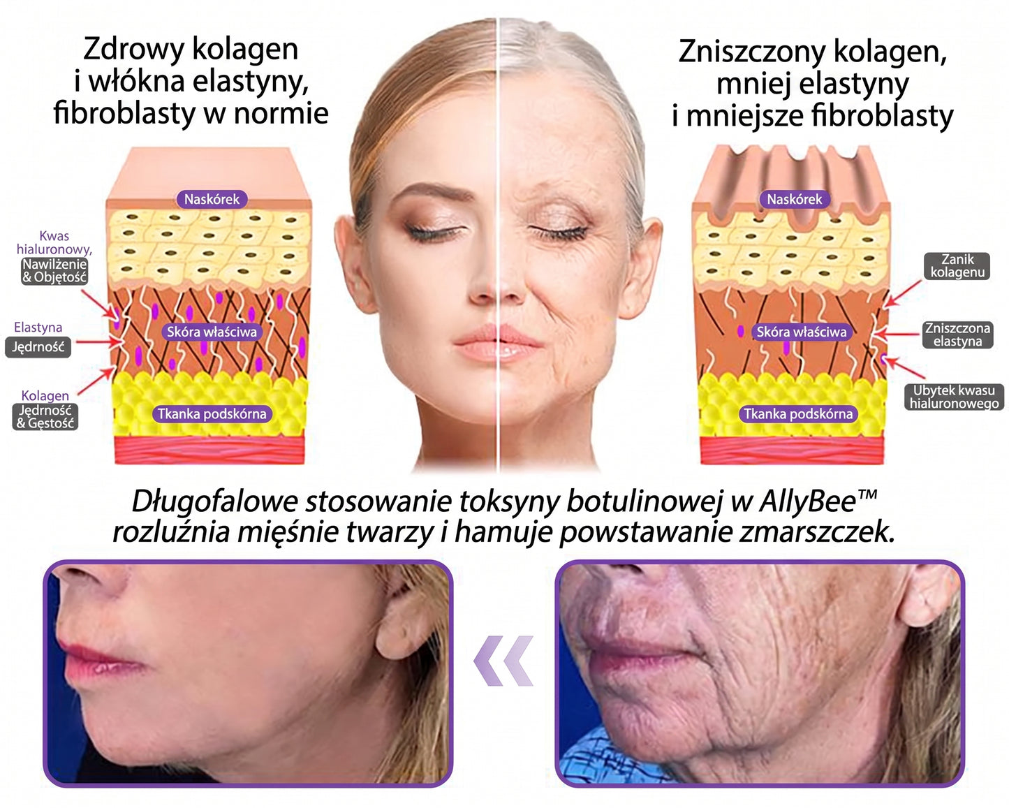 Vitalisys®🍇 PDRN Multi-Peptide Krem do masażu w rolerze do ciała — przeciwstarzeniowy, nawilżający, ujędrniający i liftingujący, wspiera regenerację skóry, wyrównuje koloryt, pomaga w pielęgnacji niedoskonałości i ciemnych plam.