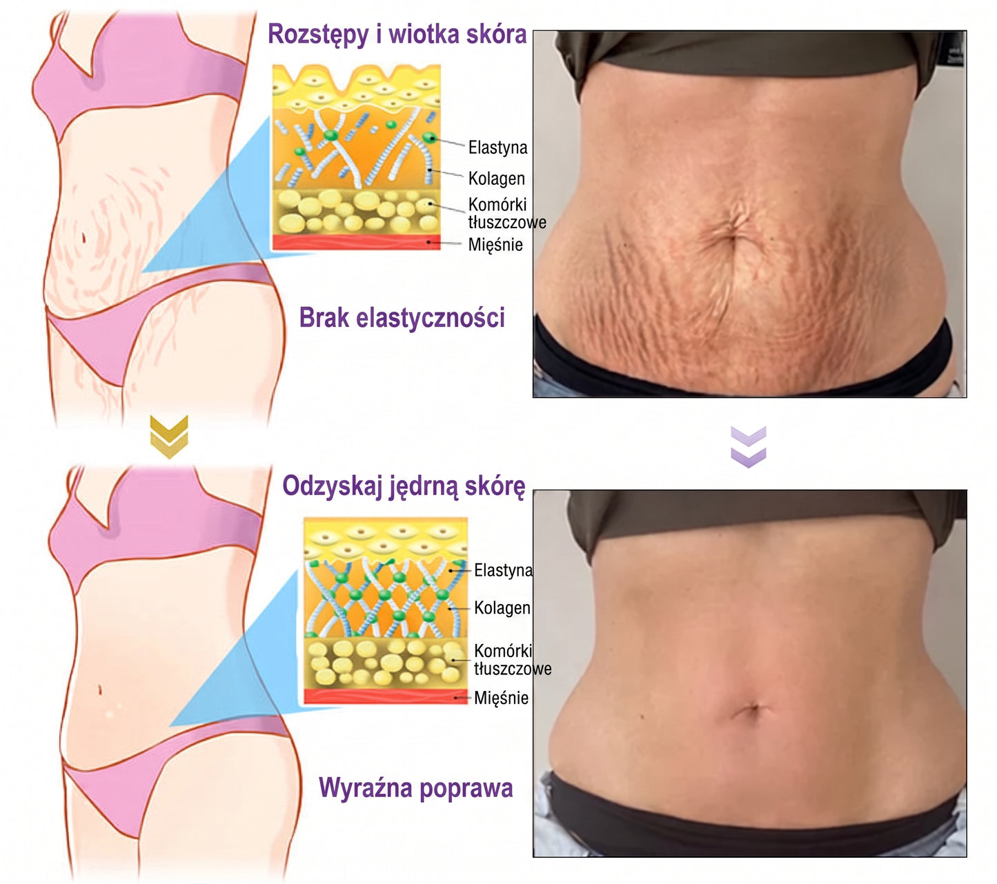 Vitalisys®🍇 PDRN Multi-Peptide Krem do masażu w rolerze do ciała — przeciwstarzeniowy, nawilżający, ujędrniający i liftingujący, wspiera regenerację skóry, wyrównuje koloryt, pomaga w pielęgnacji niedoskonałości i ciemnych plam.