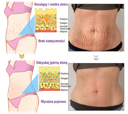 Vitalisys®🍇 PDRN Multi-Peptide Krem do masażu w rolerze do ciała — przeciwstarzeniowy, nawilżający, ujędrniający i liftingujący, wspiera regenerację skóry, wyrównuje koloryt, pomaga w pielęgnacji niedoskonałości i ciemnych plam.