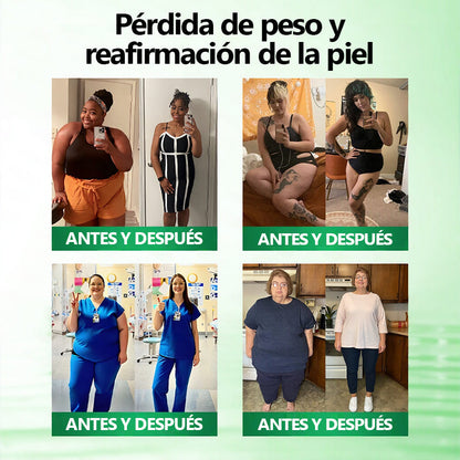 Descuento exclusivo del 30% 𝘊𝘭í𝘯𝘪𝘤𝘢𝘮𝘦𝘯𝘵𝘦 𝘱𝘳𝘰𝘣𝘢𝘥𝘰👩‍⚕️|𝙈𝑼𝐑𝒲𝓞𝙽® 𝑴-𝑩-𝙉 𝙋𝙖𝙧𝙘𝙝𝙚 𝑴𝒆𝒕𝒂𝒃ó𝒍𝒊𝒄𝒐 𝐍𝐚𝐧𝐨-𝐅𝐮𝐬𝐢ó𝐧🍉𝑨𝒗𝒂𝒍𝒂𝒅𝒐 𝐜𝐢𝐞𝐧𝐭í𝐟𝐢𝐜𝐚𝐦𝐞𝐧𝐭𝐞 | 𝙁ó𝙧𝙢𝙪𝙡𝙖 𝟭𝟎-𝙚𝙣-1 | 𝙍𝙚𝙨𝙪𝙡𝙩𝙖𝙙𝙤𝙨 𝙚𝙣 𝙨𝙤𝙡𝙤 𝟕 𝙙í𝙖𝙨🫐