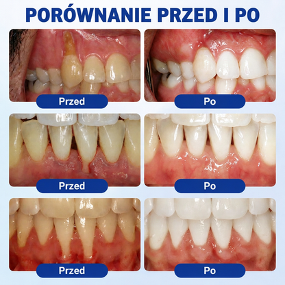 🇵🇱 𝑽𝒊𝒕𝒂𝒍𝒊𝒔𝒚𝒔®🦷 𝑮𝒖𝒎𝑹𝒆𝒗𝒊𝒗𝒆 𝑷𝒂𝒓𝒐𝒅𝒐𝒏𝒕𝒂𝒍𝒏𝒚 𝑮𝒆𝒍 𝑶𝒅𝒏𝒂𝒘𝒊𝒂𝒋ą𝒄𝒚🍇