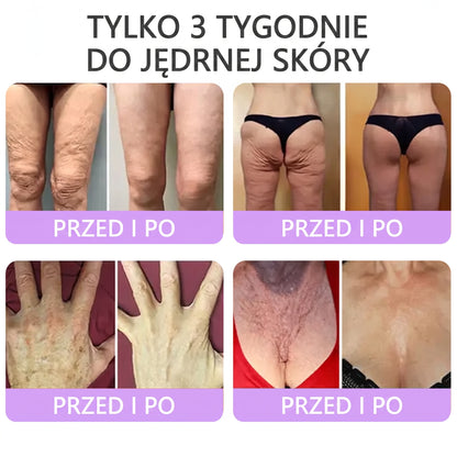Vitalisys®🍇 PDRN Multi-Peptide Krem do masażu w rolerze do ciała — przeciwstarzeniowy, nawilżający, ujędrniający i liftingujący, wspiera regenerację skóry, wyrównuje koloryt, pomaga w pielęgnacji niedoskonałości i ciemnych plam.