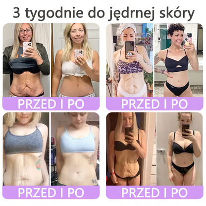 Vitalisys®🍇 PDRN Multi-Peptide Krem do masażu w rolerze do ciała — przeciwstarzeniowy, nawilżający, ujędrniający i liftingujący, wspiera regenerację skóry, wyrównuje koloryt, pomaga w pielęgnacji niedoskonałości i ciemnych plam.
