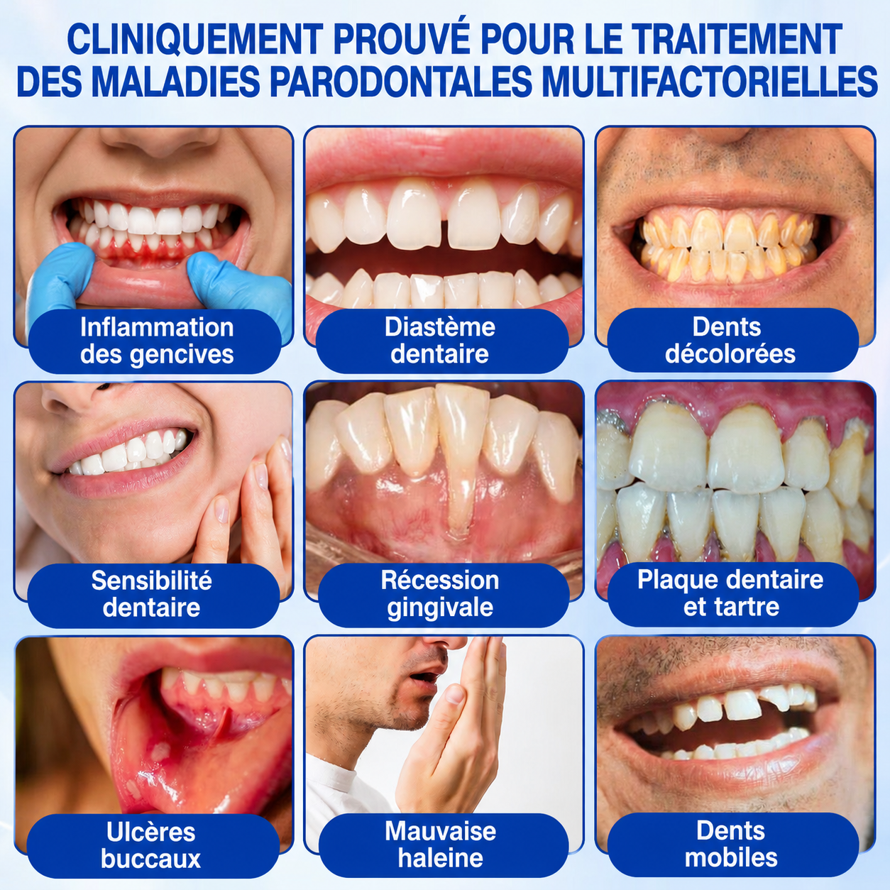 🇫🇷 𝑮𝒍𝒊𝒎𝒎𝒆𝒓𝒍𝒚®🦷 𝑮𝒖𝒎𝑹𝒆𝒗𝒊𝒗𝒆 𝑮𝒆𝒍 𝒅𝒆 𝑹é𝒑𝒂𝒓𝒂𝒕𝒊𝒐𝒏 𝑷𝒂𝒓𝒐𝒅𝒐𝒏𝒕𝒂𝒍𝒆💎