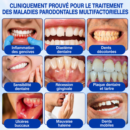 🇫🇷 𝑮𝒍𝒊𝒎𝒎𝒆𝒓𝒍𝒚®🦷 𝑮𝒖𝒎𝑹𝒆𝒗𝒊𝒗𝒆 𝑮𝒆𝒍 𝒅𝒆 𝑹é𝒑𝒂𝒓𝒂𝒕𝒊𝒐𝒏 𝑷𝒂𝒓𝒐𝒅𝒐𝒏𝒕𝒂𝒍𝒆💎