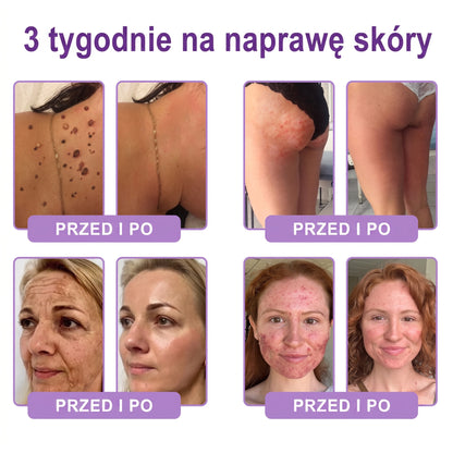 Vitalisys®🍇 PDRN Multi-Peptide Krem do masażu w rolerze do ciała — przeciwstarzeniowy, nawilżający, ujędrniający i liftingujący, wspiera regenerację skóry, wyrównuje koloryt, pomaga w pielęgnacji niedoskonałości i ciemnych plam.