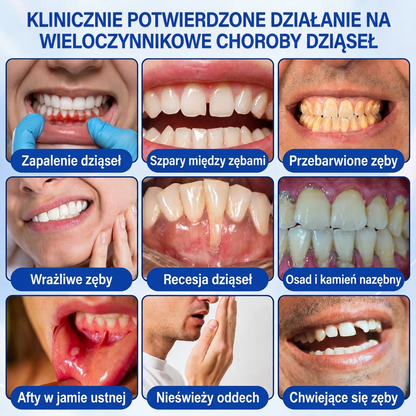 🇵🇱 𝑽𝒊𝒕𝒂𝒍𝒊𝒔𝒚𝒔®🦷 𝑮𝒖𝒎𝑹𝒆𝒗𝒊𝒗𝒆 𝑷𝒂𝒓𝒐𝒅𝒐𝒏𝒕𝒂𝒍𝒏𝒚 𝑮𝒆𝒍 𝑶𝒅𝒏𝒂𝒘𝒊𝒂𝒋ą𝒄𝒚🍇