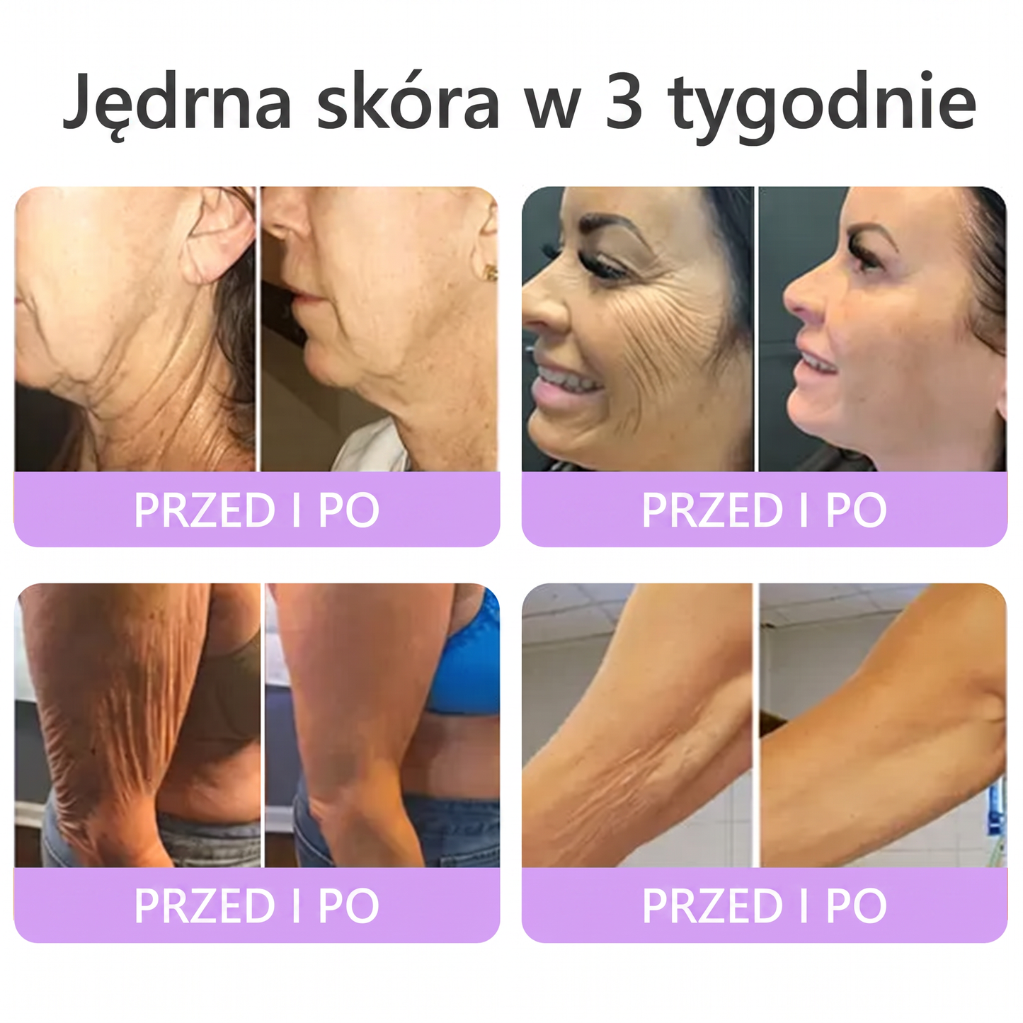 Vitalisys®🍇 PDRN Multi-Peptide Krem do masażu w rolerze do ciała — przeciwstarzeniowy, nawilżający, ujędrniający i liftingujący, wspiera regenerację skóry, wyrównuje koloryt, pomaga w pielęgnacji niedoskonałości i ciemnych plam.