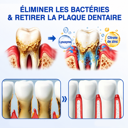 🇫🇷 𝑮𝒍𝒊𝒎𝒎𝒆𝒓𝒍𝒚®🦷 𝑮𝒖𝒎𝑹𝒆𝒗𝒊𝒗𝒆 𝑮𝒆𝒍 𝒅𝒆 𝑹é𝒑𝒂𝒓𝒂𝒕𝒊𝒐𝒏 𝑷𝒂𝒓𝒐𝒅𝒐𝒏𝒕𝒂𝒍𝒆💎