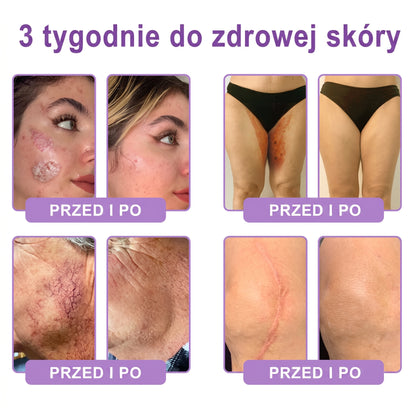 Vitalisys®🍇 PDRN Multi-Peptide Krem do masażu w rolerze do ciała — przeciwstarzeniowy, nawilżający, ujędrniający i liftingujący, wspiera regenerację skóry, wyrównuje koloryt, pomaga w pielęgnacji niedoskonałości i ciemnych plam.