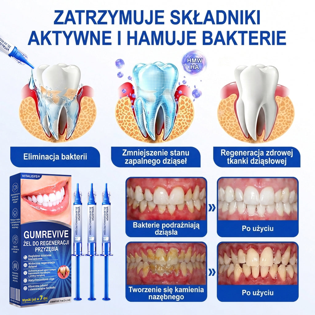 🇵🇱 𝑽𝒊𝒕𝒂𝒍𝒊𝒔𝒚𝒔®🦷 𝑮𝒖𝒎𝑹𝒆𝒗𝒊𝒗𝒆 𝑷𝒂𝒓𝒐𝒅𝒐𝒏𝒕𝒂𝒍𝒏𝒚 𝑮𝒆𝒍 𝑶𝒅𝒏𝒂𝒘𝒊𝒂𝒋ą𝒄𝒚🍇