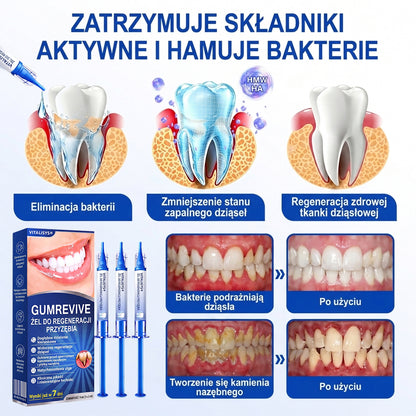 🇵🇱 𝑽𝒊𝒕𝒂𝒍𝒊𝒔𝒚𝒔®🦷 𝑮𝒖𝒎𝑹𝒆𝒗𝒊𝒗𝒆 𝑷𝒂𝒓𝒐𝒅𝒐𝒏𝒕𝒂𝒍𝒏𝒚 𝑮𝒆𝒍 𝑶𝒅𝒏𝒂𝒘𝒊𝒂𝒋ą𝒄𝒚🍇