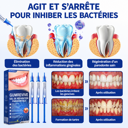 🇫🇷 𝑮𝒍𝒊𝒎𝒎𝒆𝒓𝒍𝒚®🦷 𝑮𝒖𝒎𝑹𝒆𝒗𝒊𝒗𝒆 𝑮𝒆𝒍 𝒅𝒆 𝑹é𝒑𝒂𝒓𝒂𝒕𝒊𝒐𝒏 𝑷𝒂𝒓𝒐𝒅𝒐𝒏𝒕𝒂𝒍𝒆💎