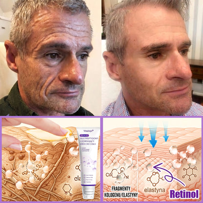 Vitalisys®🍇 PDRN Multi-Peptide Krem do masażu w rolerze do ciała — przeciwstarzeniowy, nawilżający, ujędrniający i liftingujący, wspiera regenerację skóry, wyrównuje koloryt, pomaga w pielęgnacji niedoskonałości i ciemnych plam.